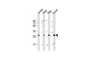 All lanes : Anti-ANP32A Antibody (Center) at 1:2000 dilution Lane 1: Jurkat whole cell lysate Lane 2: Hela whole cell lysate Lane 3: Raji whole cell lysate Lane 4: Daudi whole cell lysate Lysates/proteins at 20 μg per lane. (PHAP1 antibody  (AA 133-162))