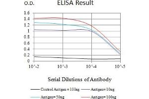 Black line: Control Antigen (100 ng),Purple line: Antigen (10 ng), Blue line: Antigen (50 ng), Red line:Antigen (100 ng) (BAX antibody)
