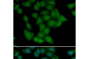 Immunofluorescence analysis of U2OS cells using CAMK1 Polyclonal Antibody (CAMK1 antibody)