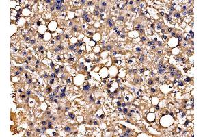 IHC analysis of PPFIA1 using anti-PPFIA1 antibody (ABIN7600454). (PPFIA1 antibody  (AA 198-1202))