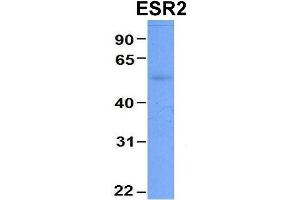 Host:  Rabbit  Target Name:  CHAD  Sample Type:  Human Adult Placenta  Antibody Dilution:  1. (ESR2 antibody  (Middle Region))