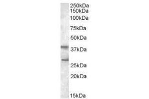 Image no. 1 for anti-Src Kinase Associated Phosphoprotein 2 (SKAP2) (C-Term) antibody (ABIN374180)