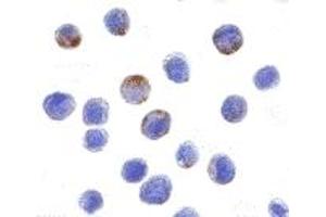 Immunohistochemistry (IHC) image for anti-DEAD (Asp-Glu-Ala-Asp) Box Polypeptide 3, X-Linked (DDX3X) (N-Term) antibody (ABIN1031348) (DDX3X antibody  (N-Term))