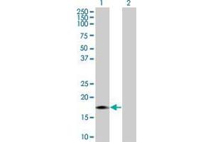 Lane 1: MAP1LC3A transfected lysate ( 13.