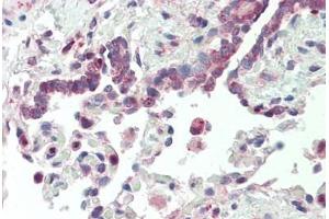 Human, Lung: Formalin-Fixed Paraffin-Embedded (FFPE) (VARS antibody  (AA 576-625))