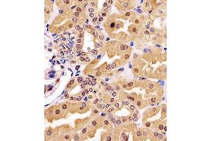 (ABIN6243211 and ABIN6577174) staining GDH in human kidney tissue sections by Immunohistochemistry (IHC-P - paraformaldehyde-fixed, paraffin-embedded sections). (GAPDH antibody  (AA 43-335))