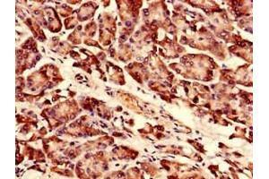 Immunocytochemistry analysis of human pancreatic tissue using ABIN7142719 at dilution of 1:100 (RPLP0 antibody  (AA 1-317))