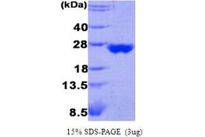 SDS-PAGE (SDS) image for Peroxiredoxin 3 (PRDX3) (AA 63-256) protein (ABIN667738)