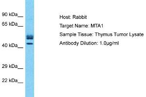Host: Rabbit Target Name: MTA1 Sample Type: Thymus Tumor lysates Antibody Dilution: 1. (MTA1 antibody  (Middle Region))