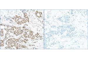 Immunohistochemistry (IHC) image for anti-Replication Protein A2, 32kDa (RPA2) (pSer4), (pSer8) antibody (ABIN7455212) (RPA2 antibody  (pSer4, pSer8))