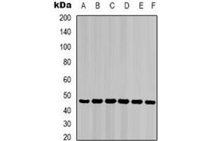 Western blot analysis of Cytokeratin 18 expression in HepG2 (A), Hela (B), mouse liver (C), mouse skeletal muscle (D), C2C12 (E), rat heart (F) whole cell lysates. (Cytokeratin 18 antibody)