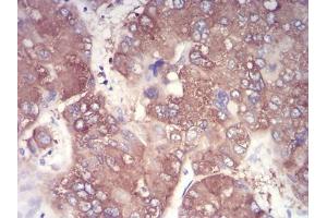 Immunohistochemistry (IHC) image for anti-Nuclear Factor of kappa Light Polypeptide Gene Enhancer in B-Cells Inhibitor, alpha (NFKBIA) (AA 150-291) antibody (ABIN5542657)