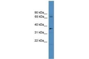 Splicing Factor 4 antibody  (C-Term)