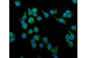 IF analysis of Podoplanin/gp36/Pdpn using anti-Podoplanin/gp36/Pdpn antibody (ABIN7600811).