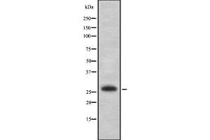 Western blot analysis of EMX2 using K562 whole cell lysates (EMX2 antibody  (N-Term))
