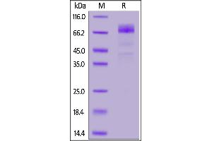Biotinylated Human CD36, His,Avitag on  under reducing (R) condition. (CD36 Protein (CD36) (AA 30-439) (His tag,AVI tag,Biotin))