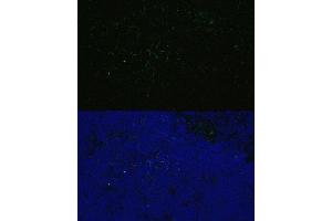 Immunofluorescence analysis of Mouse thymus using CD4 antibody (ABIN6132069, ABIN6138186, ABIN6138188 and ABIN6213820) at dilution of 1:100. (CD4 antibody  (AA 26-200))