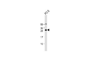 Anti-FA Antibody (N-Term) at 1:2000 dilution + PC-3 whole cell lysate Lysates/proteins at 20 μg per lane.