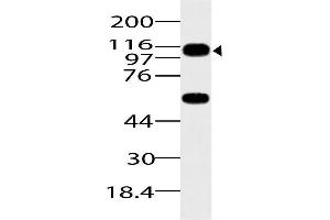 Image no. 1 for anti-ArfGAP with SH3 Domain, Ankyrin Repeat and PH Domain 1 (ASAP1) (AA 912-1115) antibody (ABIN5027041) (ASAP1 antibody  (AA 912-1115))