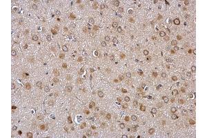 IHC-P Image Galanin Receptor 2 antibody detects Galanin Receptor 2 protein at membrane and cytosol on rat fore brain by immunohistochemical analysis. (GALR2 antibody  (C-Term))