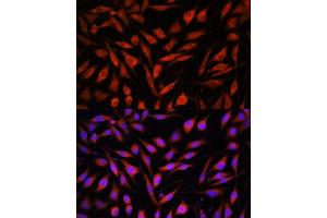 Immunofluorescence analysis of L929 cells using FBXO21 antibody (ABIN7267085) at dilution of 1:100.