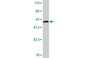 Western Blot detection against Immunogen (60. (DHRS9 antibody  (AA 1-319))