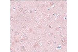 Immunohistochemistry of SYNGR2 in rat brain tissue with this product at 2.