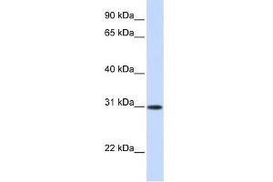 ATF5 antibody used at 0. (ATF5 antibody  (Middle Region))