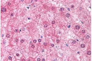 Human Liver (formalin-fixed, paraffin-embedded) stained with EIF2AK2 antibody ABIN213926 at 5 ug/ml followed by biotinylated goat anti-rabbit IgG secondary antibody ABIN481713, alkaline phosphatase-streptavidin and chromogen. (EIF2AK2 antibody  (N-Term))