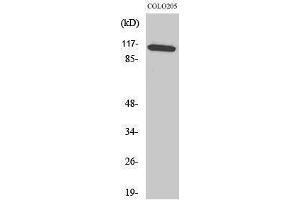 Western Blotting (WB) image for anti-Mitogen-Activated Protein Kinase 8 Interacting Protein 1 (MAPK8IP1) (Tyr466) antibody (ABIN3180130) (MAPK8IP1 antibody  (Tyr466))