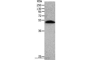 Western blot analysis of Human lung tissue, using BPIFB2 Polyclonal Antibody at dilution of 1:530 (BPIL1 antibody)