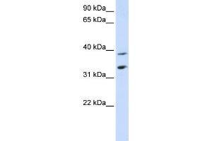 WB Suggested Anti-SLC25A34 Antibody Titration:  0.