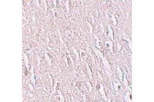 Immunohistochemical staining of human brain cells with ZBTB5 polyclonal antibody  at 2. (ZBTB5 antibody  (C-Term))