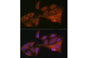 Immunofluorescence analysis of U-2 OS cells using HE4/WFDC2 Rabbit mAb (ABIN1682653, ABIN3017632, ABIN3017633 and ABIN7101513) at dilution of 1:100 (40x lens). (WFDC2 antibody)