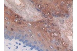 DAB staining on IHC-P; Samples: Mouse Stomach Tissue (Thymidine Phosphorylase antibody  (AA 29-305))