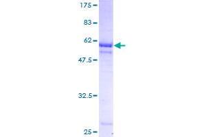 PIH1D1 Protein (AA 1-290) (GST tag)
