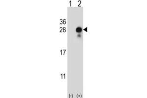 Western Blotting (WB) image for anti-delta-Like 2 Homolog (DLK2) antibody (ABIN3004005) (DLK2 antibody)