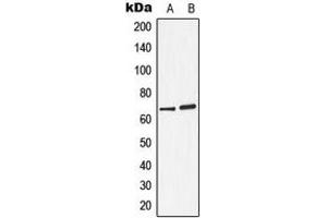 Western blot analysis of Arylsulfatase D expression in A549 (A), ZR751 (B) whole cell lysates. (Arylsulfatase D antibody  (Center))