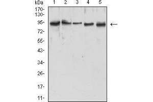 Western Blotting (WB) image for anti-MutL Homolog 1 (MLH1) (AA 381-483) antibody (ABIN7193587)