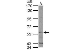 WB Image Sample (50 ug of whole cell lysate) A: mouse liver 7. (DYRK1B antibody  (N-Term))