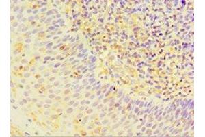 Immunohistochemistry of paraffin-embedded human tonsil tissue using ABIN7170823 at dilution of 1:100 (Striatin antibody  (AA 581-780))