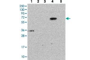 Western blot analysis of Lane 1: RT-4, Lane 2: U-251 MG, Lane 3: Human Plasma, Lane 4: Liver, Lane 5: Tonsil with ARHGAP19 polyclonal antibody . (ARHGAP19 antibody)