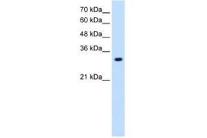 WB Suggested Anti-SLC7A8 Antibody Titration:  1. (SLC7A8 antibody  (Middle Region))