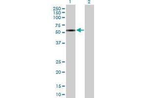 Western Blot analysis of ZNF680 expression in transfected 293T cell line by ZNF680 MaxPab polyclonal antibody. (ZNF680 antibody  (AA 1-530))
