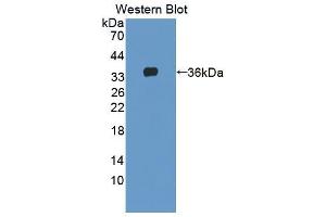 Western blot analysis of the recombinant protein. (AGRN antibody  (AA 1130-1401))