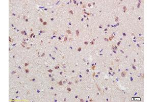 Formalin-fixed and paraffin embedded rat brain labeled with Anti-RGC32 Polyclonal Antibody, Unconjugated  at 1:200 followed by conjugation to the secondary antibody and DAB staining
