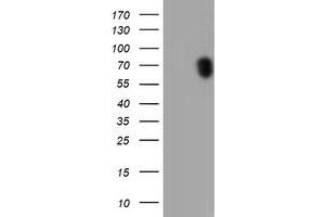 HEK293T cells were transfected with the pCMV6-ENTRY control (Left lane) or pCMV6-ENTRY RPS6KB1 (Right lane) cDNA for 48 hrs and lysed. (RPS6KB1 antibody)