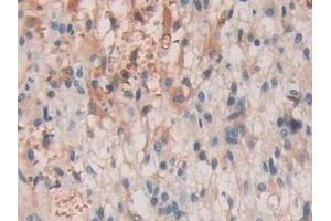 Immunohistochemistry (IHC) image for anti-SHC (Src Homology 2 Domain Containing) Transforming Protein 3 (SHC3) (AA 188-433) antibody (ABIN7443536)