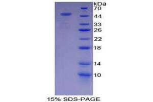 SDS-PAGE analysis of Pig Complement Component 7 Protein.