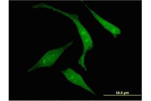 Immunofluorescence of monoclonal antibody to RGS14 on HeLa cell. (RGS14 antibody  (AA 1-566))